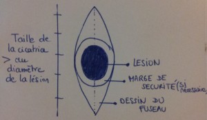 chirurgie-dermatologique-toulouse-dessin