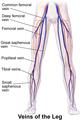 varices2.resized